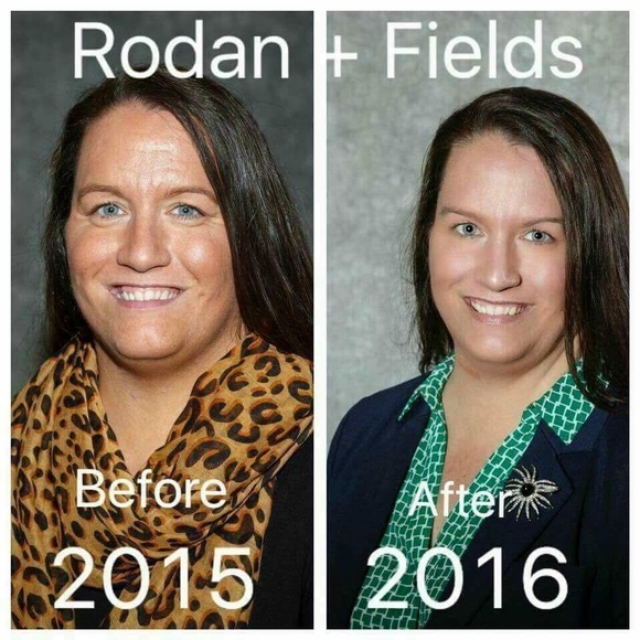 Rodan +Fields Deals and Sales - Picture 4 of 8